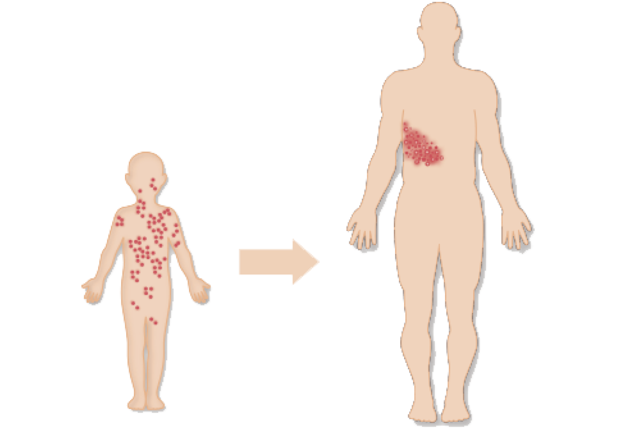 水痘・帯状疱疹ウイルス